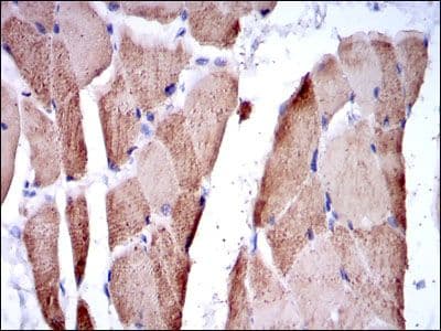 Monoclonal Mouse anti-Human TNNI2 Antibody (clone 2F12A8, IHC, WB)