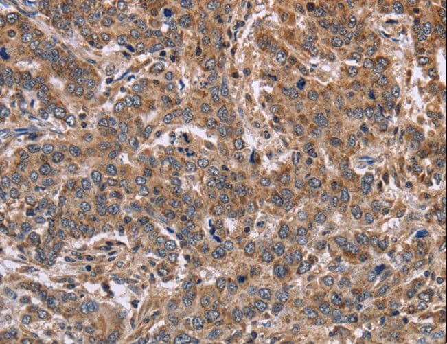 FAAH2 Antibody