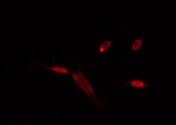 RUFY1 Antibody