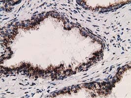 ERGIC-53 / LMAN1 Antibody (clone OTI1A8)