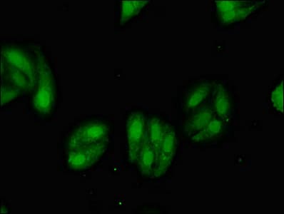 Polyclonal Rabbit anti-Human MGST2 Antibody (IHC, IF)
