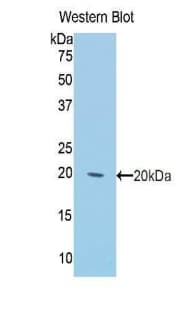 KRT2 / CK2 / Cytokeratin 2 Antibody (aa368-507, FITC)