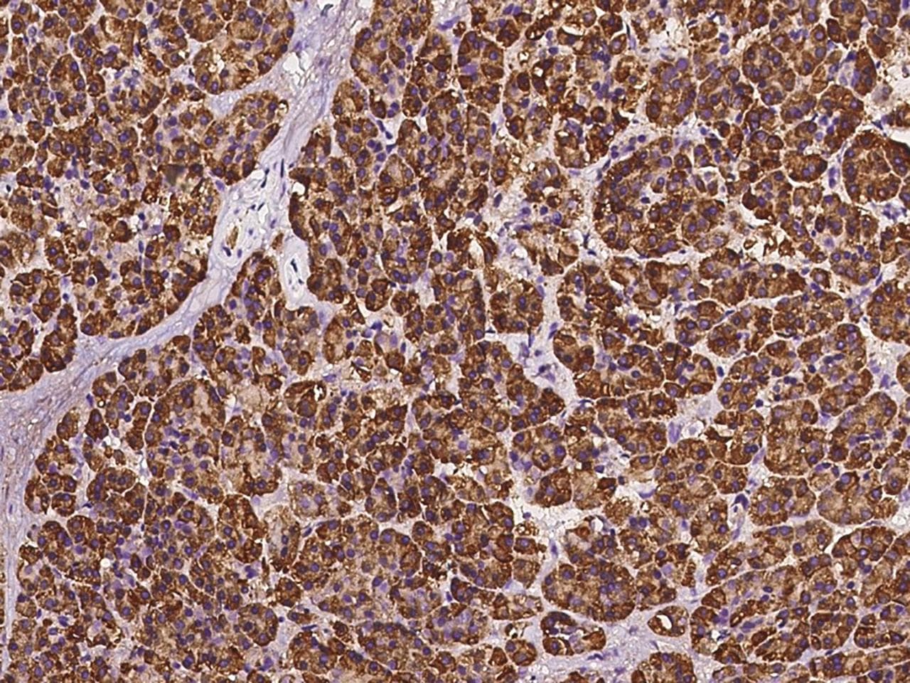 Polyclonal Rabbit anti-Human RPS5 / Ribosomal Protein S5 Antibody (IHC, IF, WB)