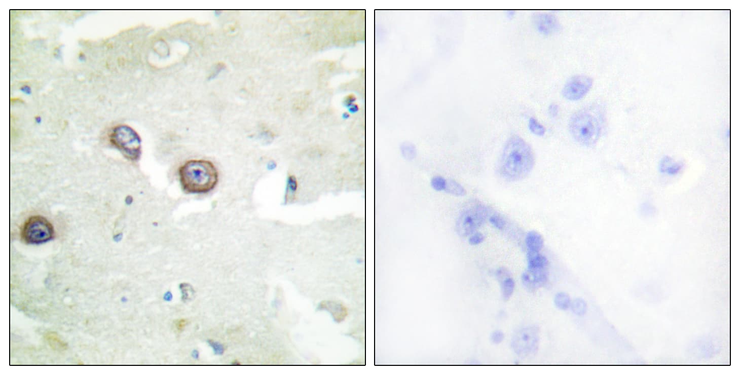CDH4 / R Cadherin Antibody (aa731-780)