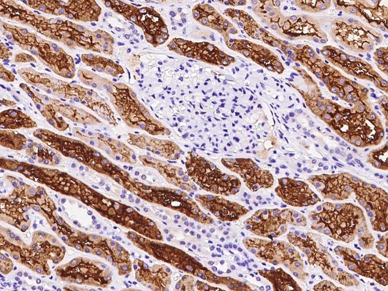 Polyclonal Rabbit anti-Human ENOSF1 Antibody (IHC)