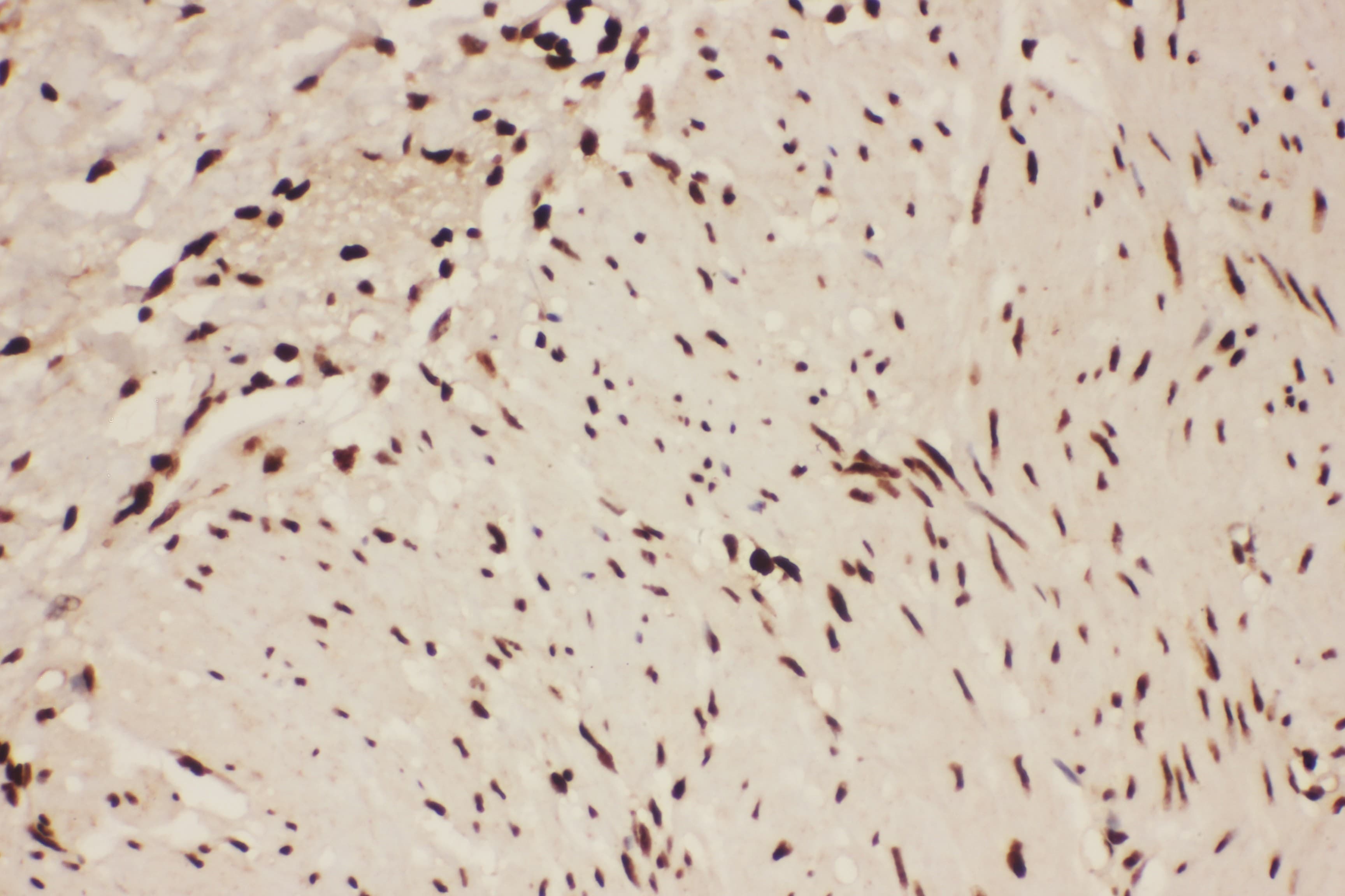 ALOX5 / 5-LOX Antibody (aa120-483)