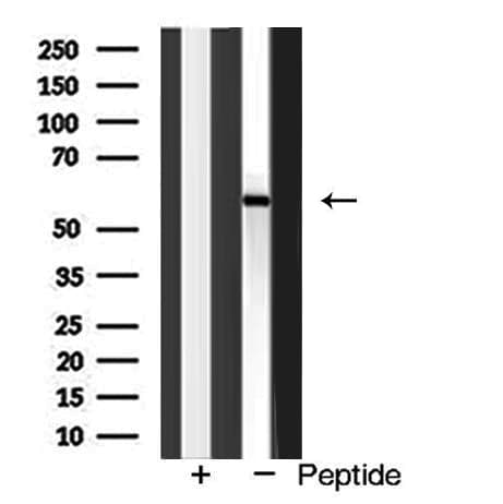 Polyclonal Rabbit anti-Human IL2RB / CD122 Antibody (IF, WB)