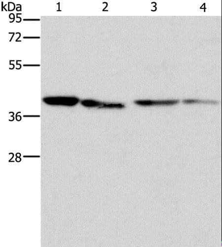 Polyclonal Rabbit anti-Human BCAT2 Antibody (IHC, WB)