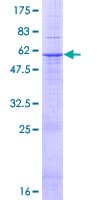 Human AGPAT2 Protein (Recombinant GST)