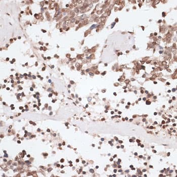 H2AFX / H2AX Antibody
