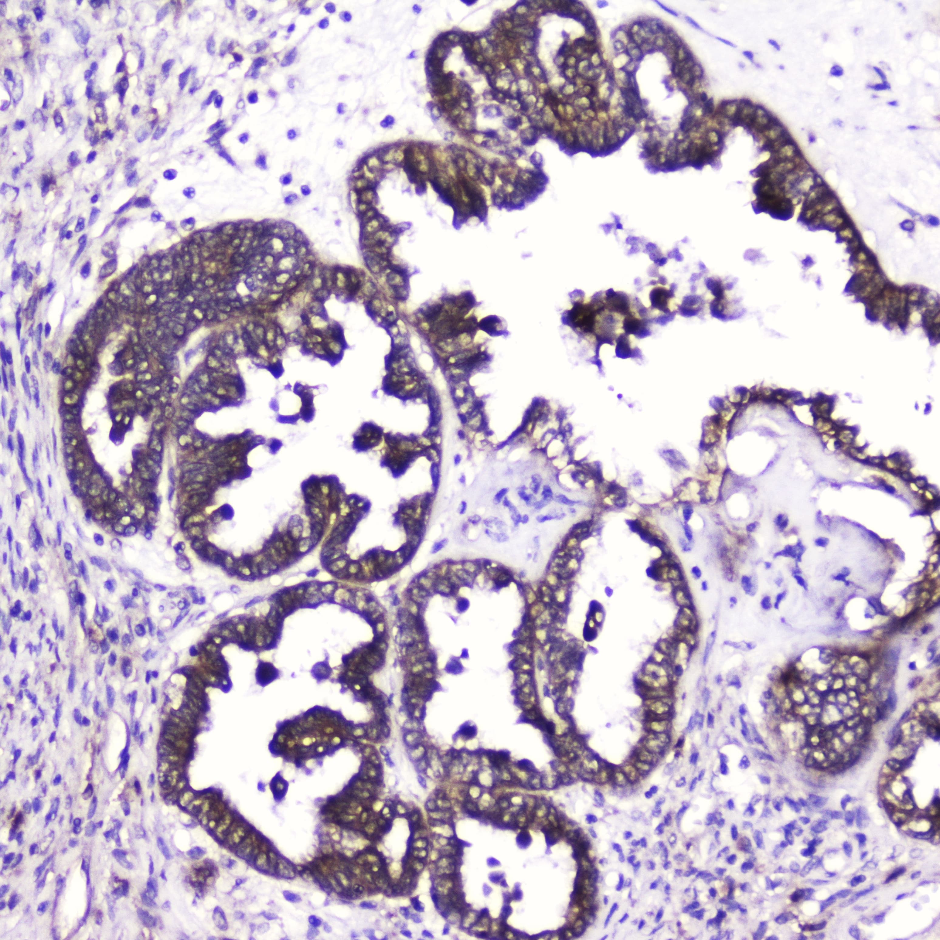 ATF4 Antibody