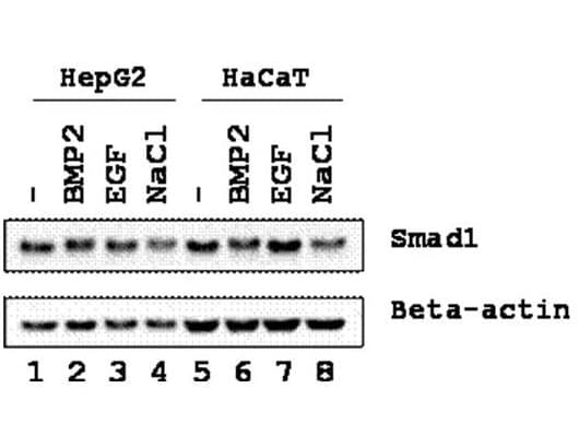 Polyclonal Rabbit anti-Human SMAD1 Antibody (WB)