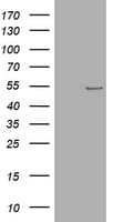 TP / Thymidine Phosphorylase Antibody (aa311-482, clone OTI4D4)