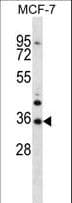 MORN3 Antibody (aa128-157)