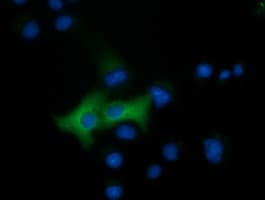 EPHX2 / Epoxide Hydrolase 2 Antibody (clone OTI3F6)