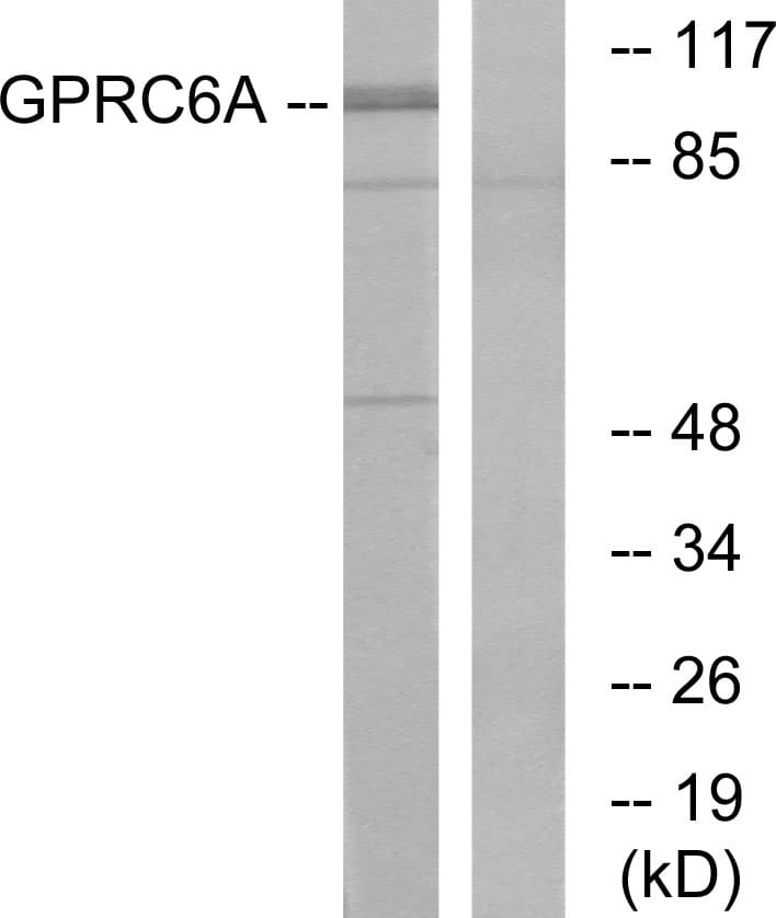 Polyclonal Rabbit anti-Human GPRC6A Antibody (aa471-520, IF, WB)