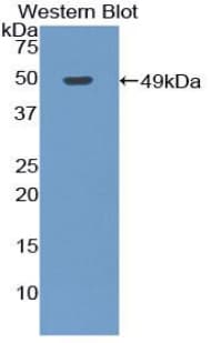 AR / Androgen Receptor Antibody (aa156-310)