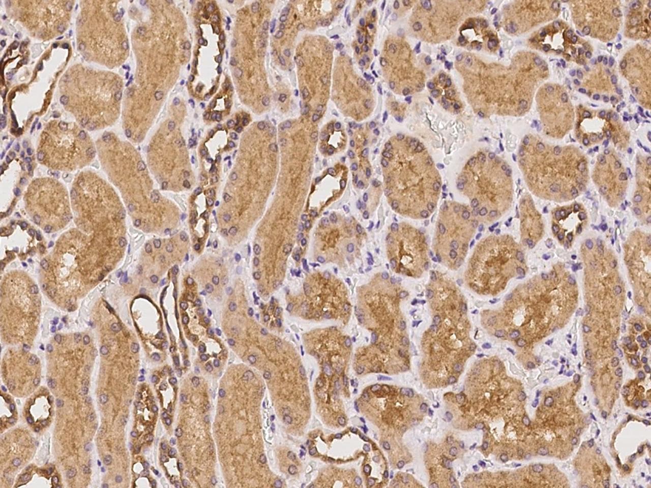 ISG54 / IFIT2 Antibody