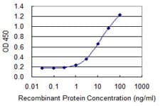 Monoclonal Mouse anti-Human SLC26A3 / DRA Antibody (clone 2E3, WB)
