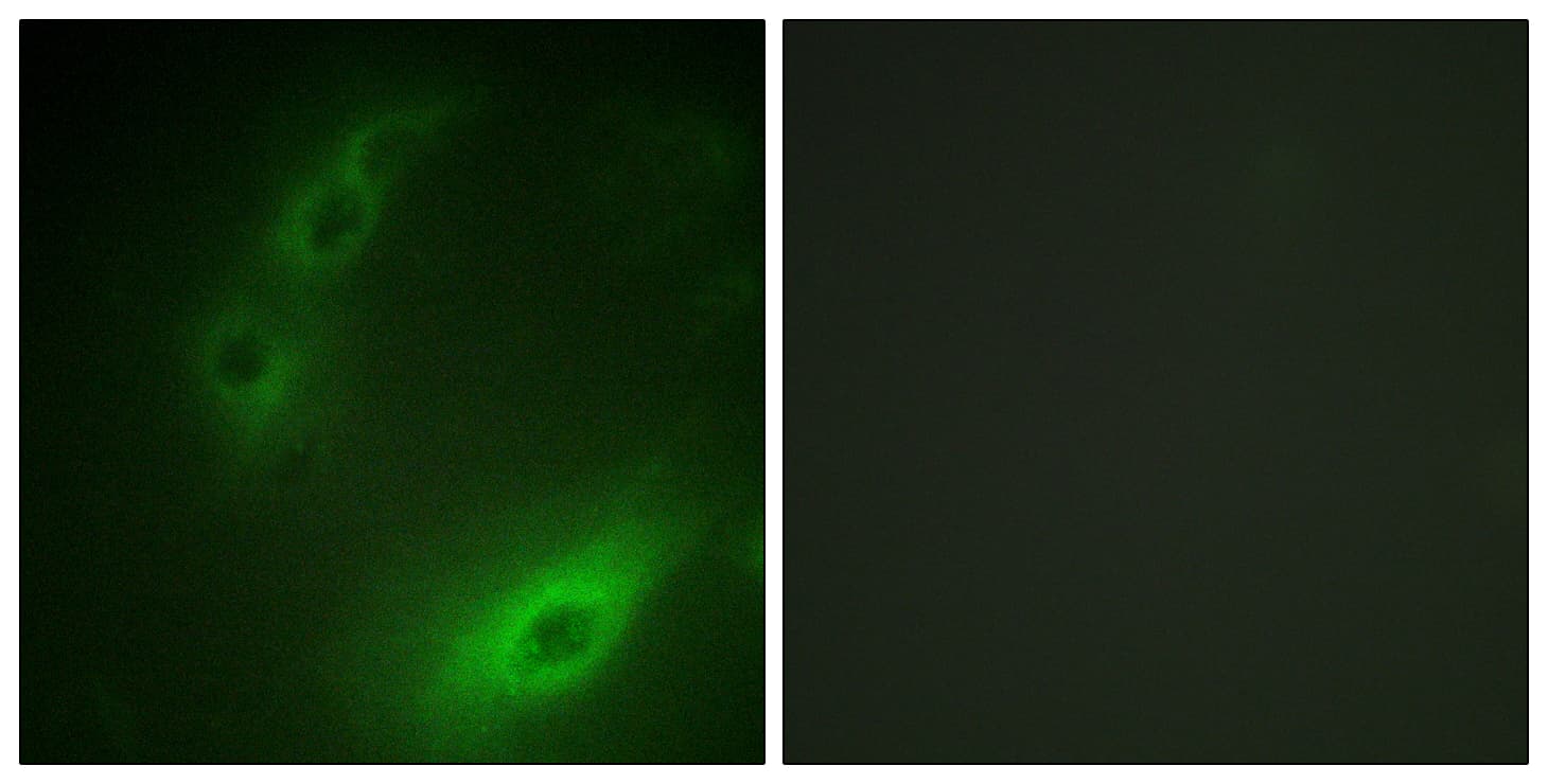 IHC-plus™ FOXO1 / FKHR Antibody (aa295-344)