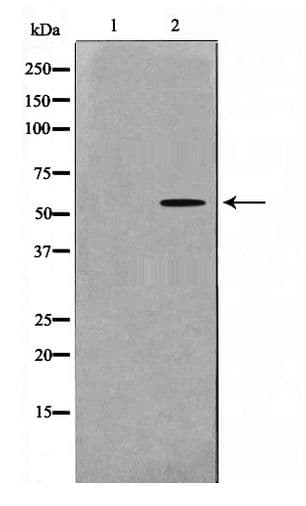 MAPKAPK5 / PRAK Antibody