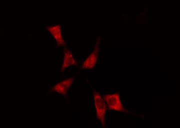 Polyclonal Rabbit anti-Human DHODH Antibody (IHC, IF, WB)