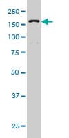 IHC-plus™ DHX9 Antibody (clone 3G7)