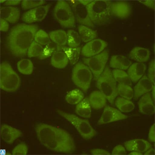 DDX3 Antibody