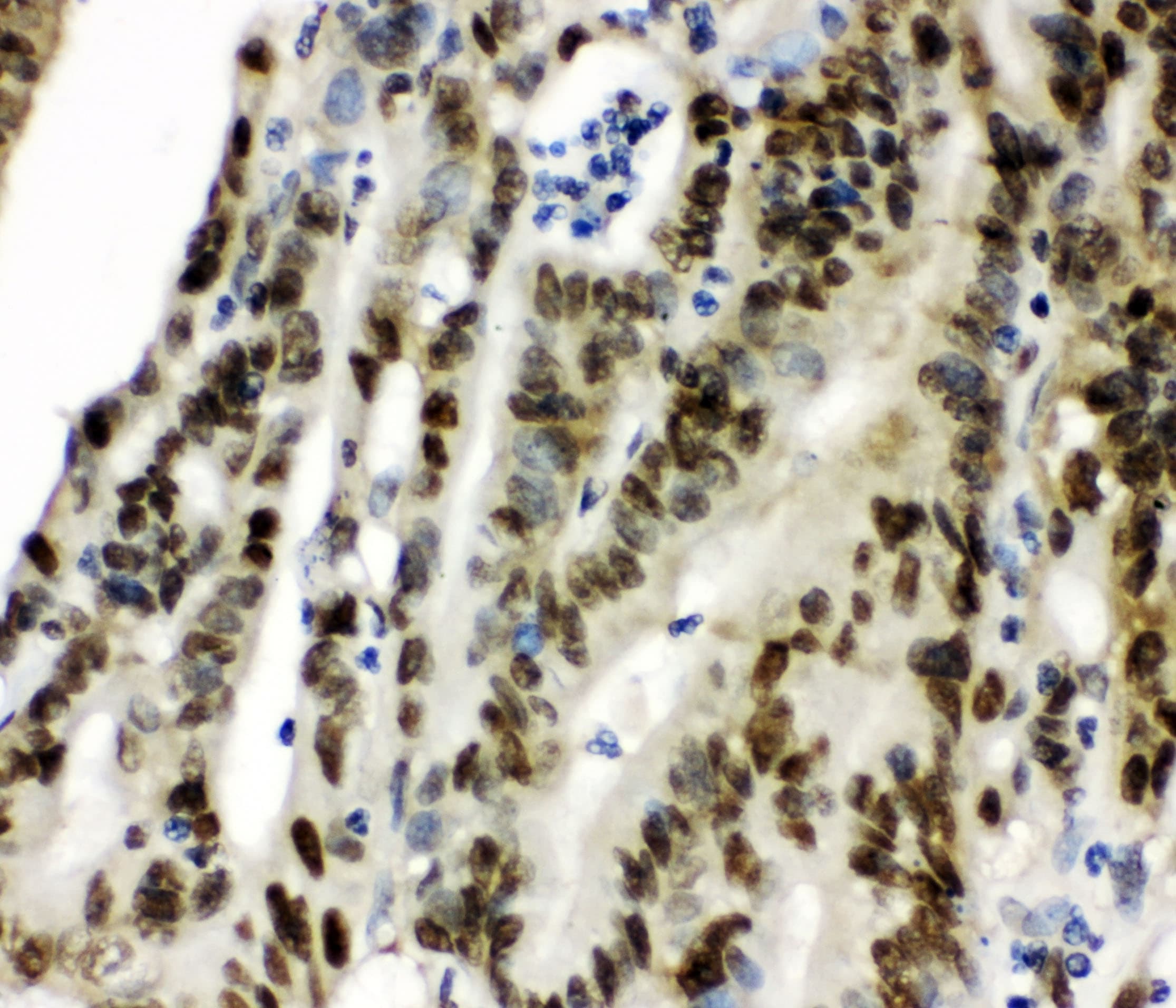 Polyclonal Rabbit anti-Human CCT3 Antibody (IHC, WB)