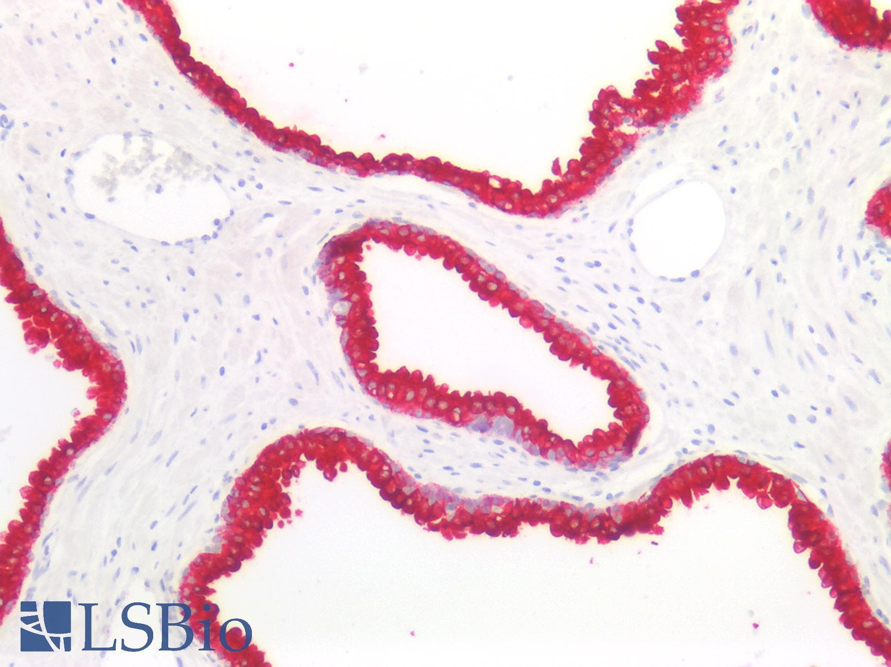 PathPlus™ Cytokeratin 8+18 Antibody (clone B22.1 & B23.1)