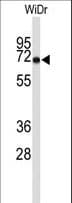 TOMM70A Antibody (aa177-205)