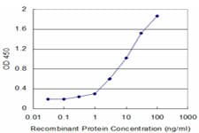 HK2 / Hexokinase 2 Antibody (clone 4H1)