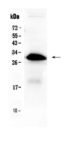 Polyclonal Rabbit anti-Human IGFBP1 Antibody (IHC, WB)