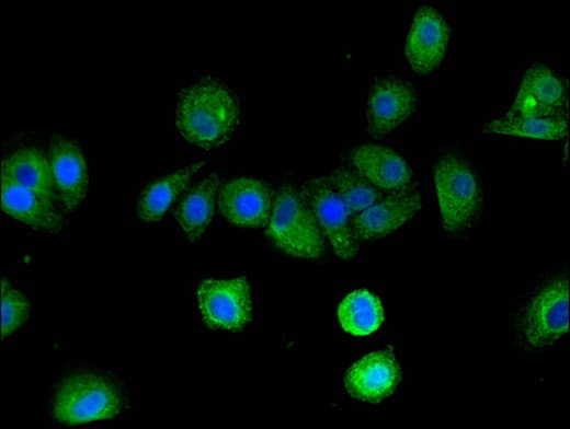 Polyclonal Rabbit anti-Human ARRB2 / Beta Arrestin 2 Antibody (IHC, IF, WB)