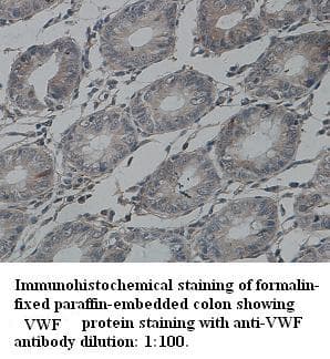 VWF / Von Willebrand Factor Antibody (Internal)
