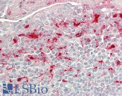IHC-plus™ ITGA3 / CD49c Antibody (clone P1B5)