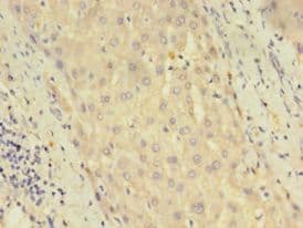 DUSP26 / MKP8 Antibody (aa1-211, Biotin)