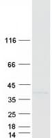 Human RFC2 / RFC40 Protein (Recombinant Myc-DDK (Flag))