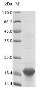 Sheep B2M / Beta 2 Microglobulin Protein (Recombinant 10His, N-terminus + Myc, C-terminus)