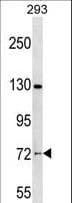 Polyclonal Rabbit anti-Human NOL4 Antibody (aa494-522, WB)