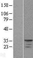 KCNIP4 / KCHIP4 Protein (Over-Expression Lysate Myc-DDK (Flag))