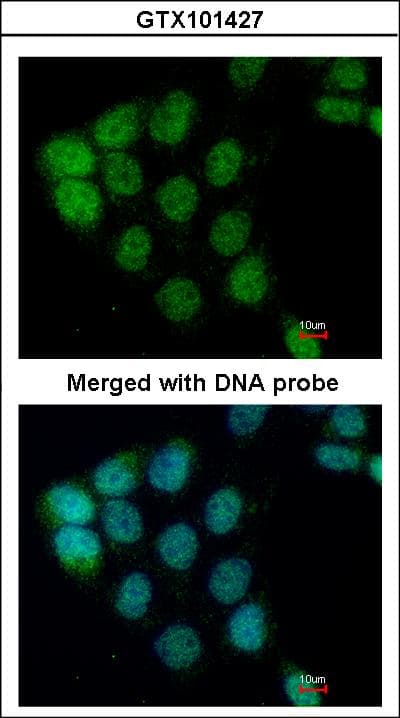 Polyclonal Rabbit anti-Human ARAF / ARAF1 / A-RAF Antibody (aa371-554, IHC, WB)