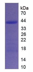 Human Procollagen I N-Terminal Propeptide Protein (Recombinant His-SUMO)