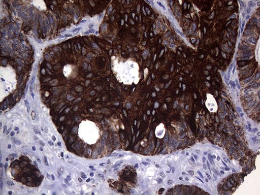KRT16 / CK16 / Cytokeratin 16 Antibody (clone OTI2F3)