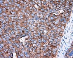 PRKAR2A Antibody (clone OTI4A3)