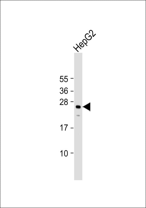 Polyclonal Rabbit anti-Human NXPH3 / Neurexophilin 3 Antibody (WB)