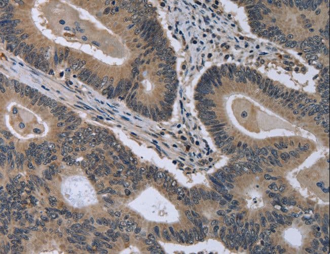 MCM3AP / GANP Antibody