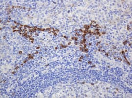 RPN2 / Ribophorin II Antibody (clone OTI1G9)