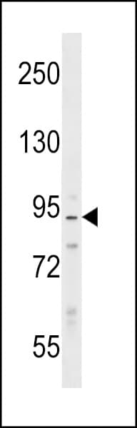 PPP1R9B / Spinophilin Antibody (aa24-53)