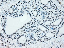 Monoclonal Mouse anti-Human BRAF / B-Raf Antibody (clone OTI4G6, IHC, WB)